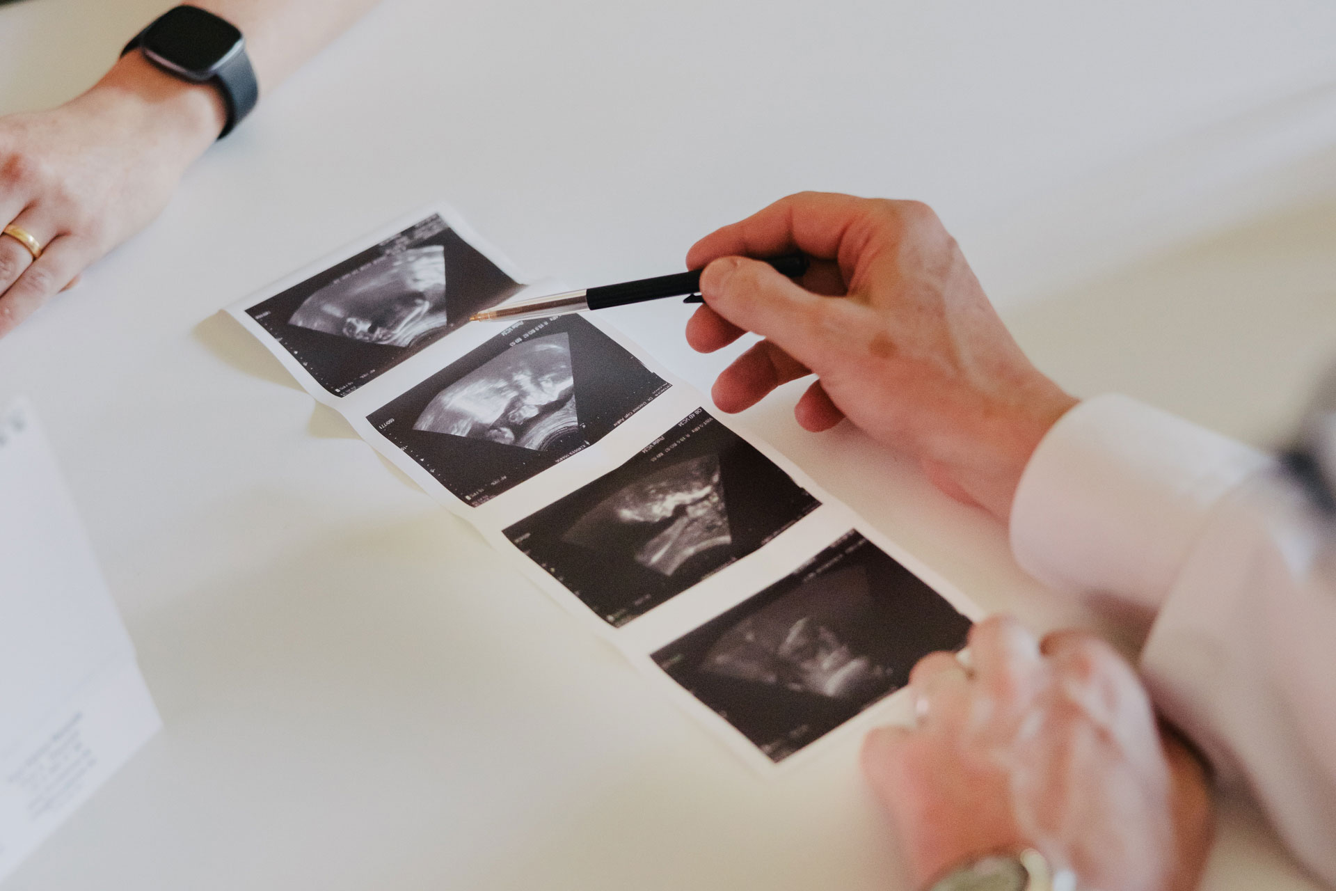 Echografie foto's worden bekeken met een pen.
